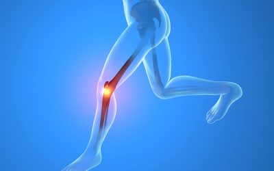 Cuatro trucos para correr sin dolor de rodilla