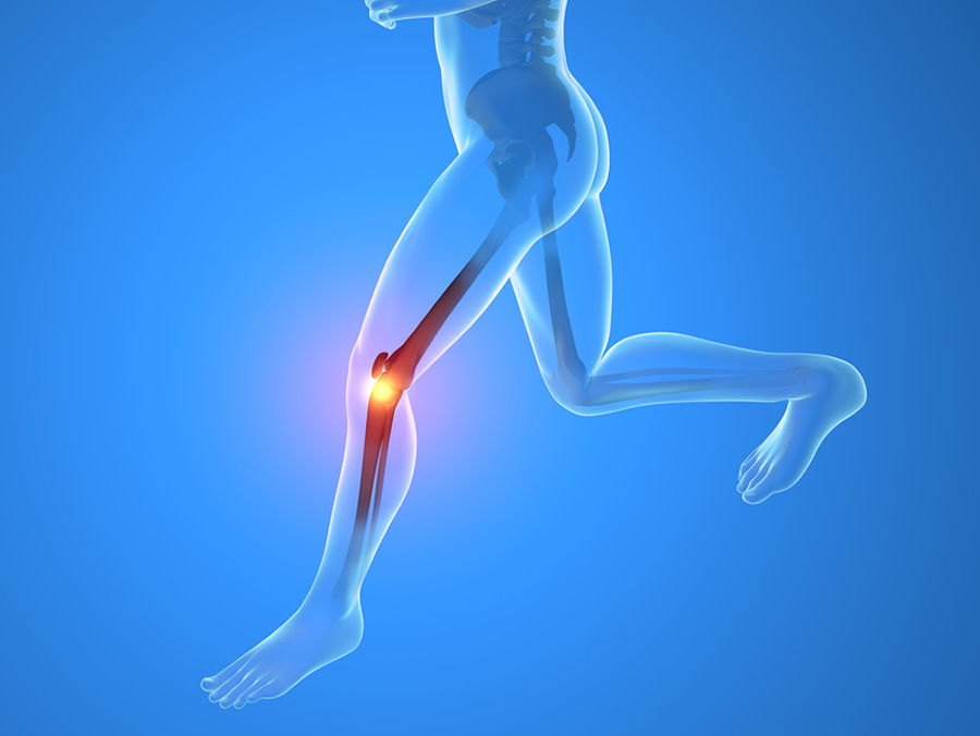 rodilla correr